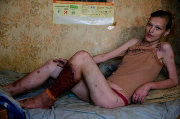 What is Krokodil?