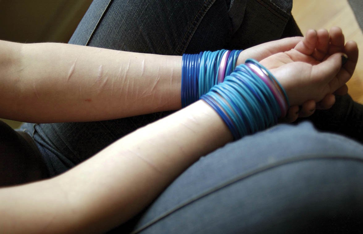 Substance Abuse and Self-Harm